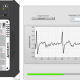 DIY ECG Monitor (1)